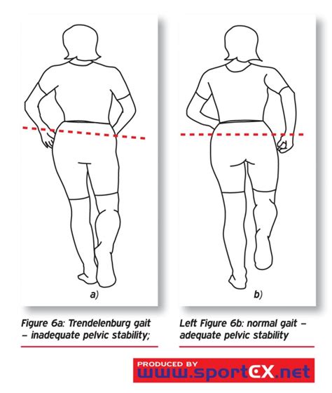 trendelenburg vs hip drop test|positive trendelenburg sign in child.